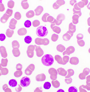 New BTK Inhibitor Pirtobrutinib Shows Promise in CLL | Nutrition Fit