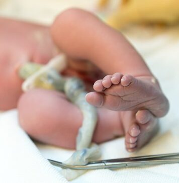 Omidubicel Improves on Umbilical Cord Blood Transplants | Nutrition Fit