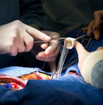Ross Procedure Stands the Critical Test of Time | Nutrition Fit