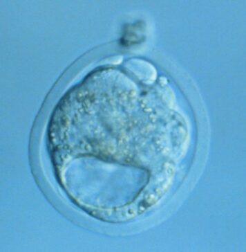 Researchers Edge Closer to Growing Human and Mice Embryos | Nutrition Fit