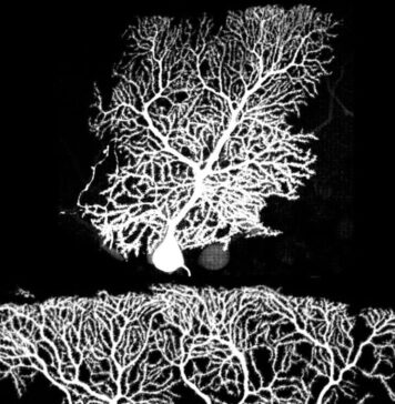 Growing Neurons Gain an Edge by Making Connections | Nutrition Fit