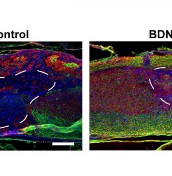 Injectable Porous Scaffolds Promote Better and Quicker Healing After Spinal Cord Injuries | Nutrition Fit