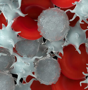 Antiplatelet Agents May Reduce Thrombotic Risk | Nutrition Fit