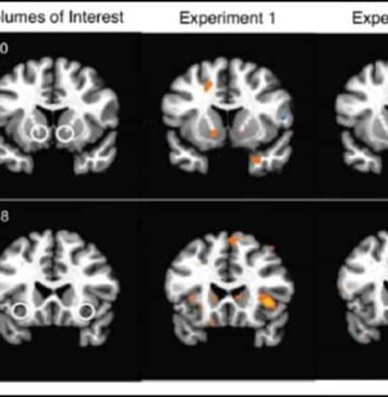 Brain Activity Foreshadows Changes in Stock Prices | Nutrition Fit