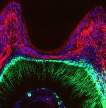 How Teeth Sense the Cold | Nutrition Fit