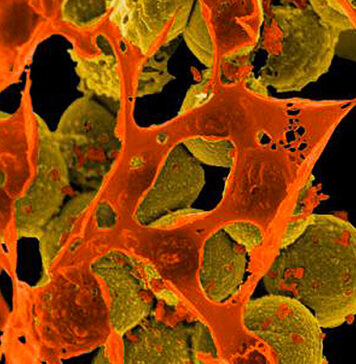 Bacteriotherapy Passes Early Test in Atopic Dermatitis Study | Nutrition Fit