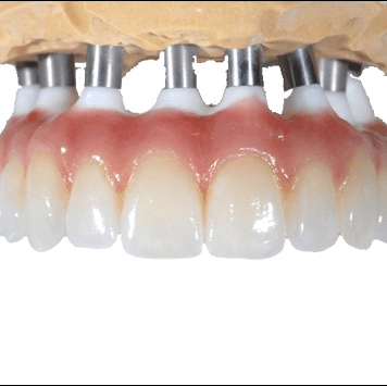 Najbolji način da poboljšate svoj osmeh bez ikakvih fizičkih promena na zubima navlake za zube