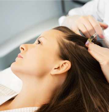 ¿Vale la pena el tratamiento de PRP para el cabello? prp para el cabello