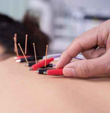 What advantages acupuncture has for one’s health