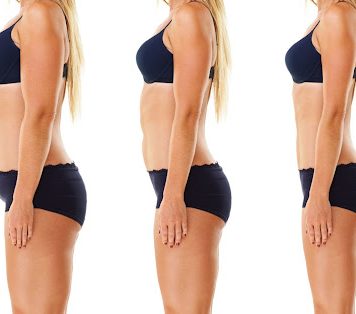 Could Semaglutide be a potential solution for weight loss?